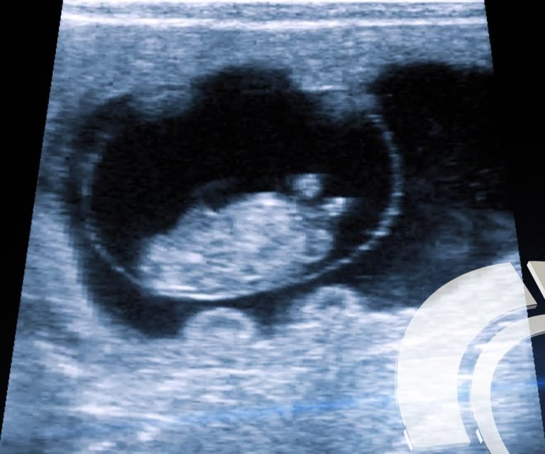 img_ecografia_reproduccion_01